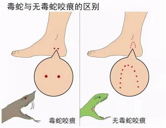 如果遇到蛇，我们应该如何自保？快学习一下吧！